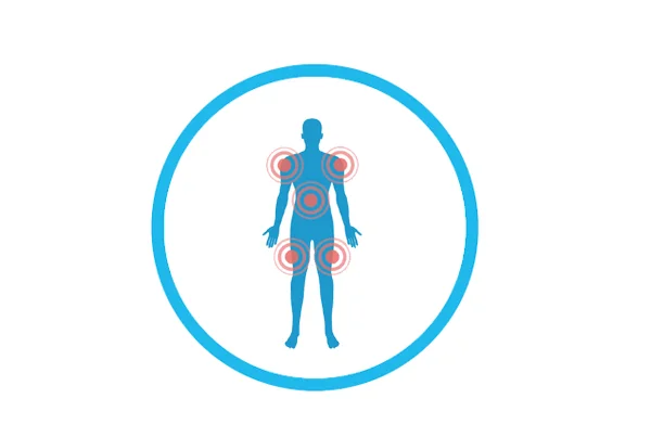 Fibromyalgia